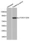 Forkhead Box O1 antibody, STJ22144, St John