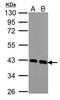 Calponin 3 antibody, PA5-28375, Invitrogen Antibodies, Western Blot image 