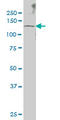 SUMO Specific Peptidase 6 antibody, LS-C133711, Lifespan Biosciences, Western Blot image 