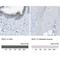 Syndecan 1 antibody, NBP1-88135, Novus Biologicals, Immunohistochemistry paraffin image 