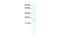 Achaete-Scute Family BHLH Transcription Factor 2 antibody, GTX44645, GeneTex, Western Blot image 