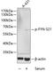 FYN Proto-Oncogene, Src Family Tyrosine Kinase antibody, A00684S21, Boster Biological Technology, Western Blot image 