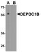 DEP Domain Containing 1B antibody, A11735, Boster Biological Technology, Western Blot image 