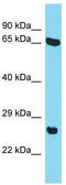 Chromosome 22 Open Reading Frame 23 antibody, TA333610, Origene, Western Blot image 