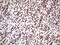 GLI Family Zinc Finger 4 antibody, NBP2-45874, Novus Biologicals, Immunohistochemistry frozen image 
