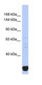 Inositol 1,4,5-Trisphosphate Receptor Type 2 antibody, orb329806, Biorbyt, Western Blot image 