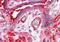 ArfGAP With Dual PH Domains 2 antibody, PA5-18207, Invitrogen Antibodies, Immunohistochemistry paraffin image 