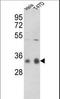 Protein Phosphatase 1 Catalytic Subunit Gamma antibody, LS-C101011, Lifespan Biosciences, Western Blot image 