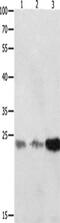 p21 antibody, CSB-PA934176, Cusabio, Western Blot image 