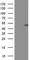 Glucosylceramidase Beta 3 (Gene/Pseudogene) antibody, CF502533, Origene, Western Blot image 