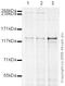 Kinesin Family Member 11 antibody, ab51976, Abcam, Western Blot image 