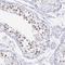 SYCP3 antibody, NBP2-48713, Novus Biologicals, Immunohistochemistry frozen image 