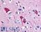 Solute Carrier Family 5 Member 11 antibody, LS-A2797, Lifespan Biosciences, Immunohistochemistry frozen image 