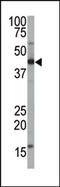 Farnesyltransferase, CAAX Box, Alpha antibody, AP12200PU-N, Origene, Western Blot image 