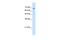 Transmembrane 9 Superfamily Member 1 antibody, PA5-42622, Invitrogen Antibodies, Western Blot image 