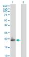 ADP Ribosylation Factor 5 antibody, H00000381-M02, Novus Biologicals, Western Blot image 