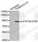 Signal Transducer And Activator Of Transcription 5A antibody, AP0139, ABclonal Technology, Western Blot image 
