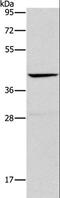 Orosomucoid 2 antibody, LS-B16384, Lifespan Biosciences, Western Blot image 