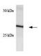 Suppressor Of Cytokine Signaling 3 antibody, GTX23693, GeneTex, Western Blot image 