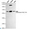 Cyp17 antibody, LS-C812933, Lifespan Biosciences, Western Blot image 