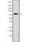 Zinc Finger Protein 441 antibody, abx219465, Abbexa, Western Blot image 