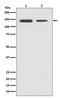 CCCTC-Binding Factor antibody, M00132, Boster Biological Technology, Western Blot image 