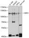 Nuclear Factor, Erythroid 2 Like 2 antibody, 13-937, ProSci, Western Blot image 