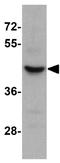 Solute Carrier Family 35 Member D3 antibody, GTX31842, GeneTex, Western Blot image 