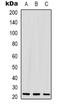 Putative teratocarcinoma-derived growth factor 2 antibody, orb339147, Biorbyt, Western Blot image 