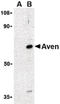 Apoptosis And Caspase Activation Inhibitor antibody, LS-B1330, Lifespan Biosciences, Western Blot image 