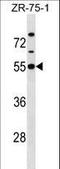 Potassium Voltage-Gated Channel Subfamily J Member 1 antibody, LS-C159974, Lifespan Biosciences, Western Blot image 