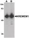Kringle Containing Transmembrane Protein 1 antibody, PA5-34520, Invitrogen Antibodies, Western Blot image 