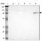 Bruton Tyrosine Kinase antibody, HPA002028, Atlas Antibodies, Western Blot image 