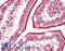 Dehydrogenase/Reductase 12 antibody, LS-B11562, Lifespan Biosciences, Immunohistochemistry frozen image 