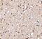 BR Serine/Threonine Kinase 2 antibody, NBP1-77281, Novus Biologicals, Immunohistochemistry paraffin image 