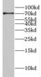 Cleavage Stimulation Factor Subunit 2 Tau Variant antibody, FNab02039, FineTest, Western Blot image 