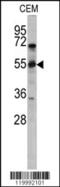 CD36 Molecule antibody, 61-575, ProSci, Western Blot image 