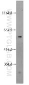 Zinc Finger And BTB Domain Containing 37 antibody, 19817-1-AP, Proteintech Group, Western Blot image 