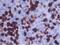 KI-67 antibody, NB110-90592, Novus Biologicals, Immunohistochemistry frozen image 