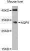 Aquaporin 5 antibody, STJ111968, St John
