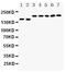 DCC Netrin 1 Receptor antibody, PA1910, Boster Biological Technology, Western Blot image 