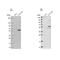 Acyl-CoA Synthetase Bubblegum Family Member 1 antibody, NBP2-58214, Novus Biologicals, Western Blot image 