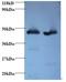 Glutamic-Oxaloacetic Transaminase 2 antibody, LS-C212149, Lifespan Biosciences, Western Blot image 