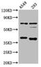 Cathepsin S antibody, CSB-PA10729A0Rb, Cusabio, Western Blot image 