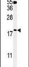 Thioredoxin Domain Containing 12 antibody, PA5-24798, Invitrogen Antibodies, Western Blot image 