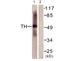 Tryptophan Hydroxylase 1 antibody, LS-B7001, Lifespan Biosciences, Western Blot image 