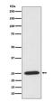 Peroxiredoxin 6 antibody, M01847, Boster Biological Technology, Western Blot image 