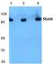 Signal Transducer And Activator Of Transcription 6 antibody, A00523-1, Boster Biological Technology, Western Blot image 