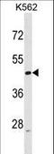 Actin Like 6A antibody, LS-C155997, Lifespan Biosciences, Western Blot image 