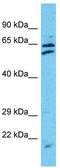 Tetratricopeptide Repeat Domain 24 antibody, TA330803, Origene, Western Blot image 